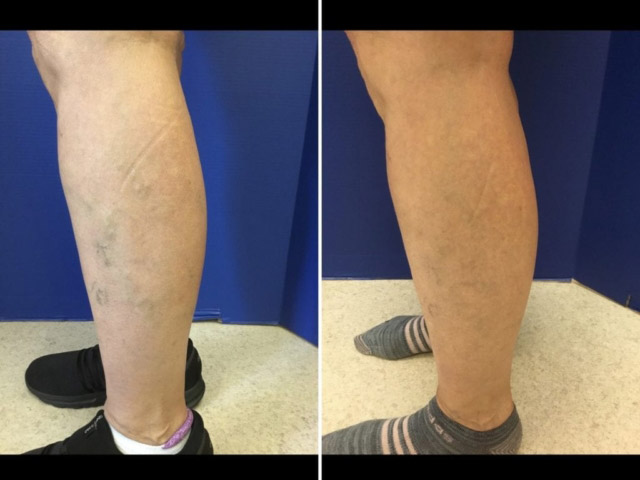 patient before and after image 1