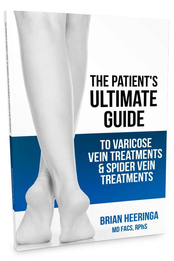 your guide to varicose veins treatment