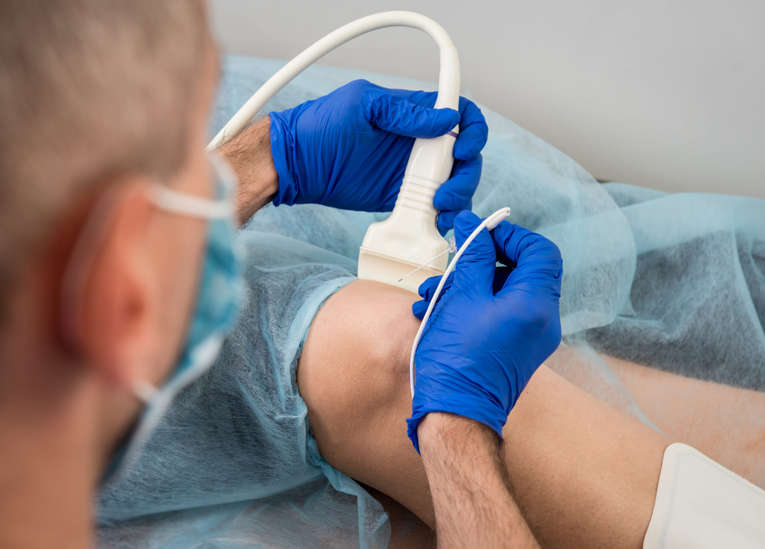 Ablation laser therapy at NMVS