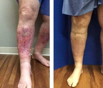 Before-and-After