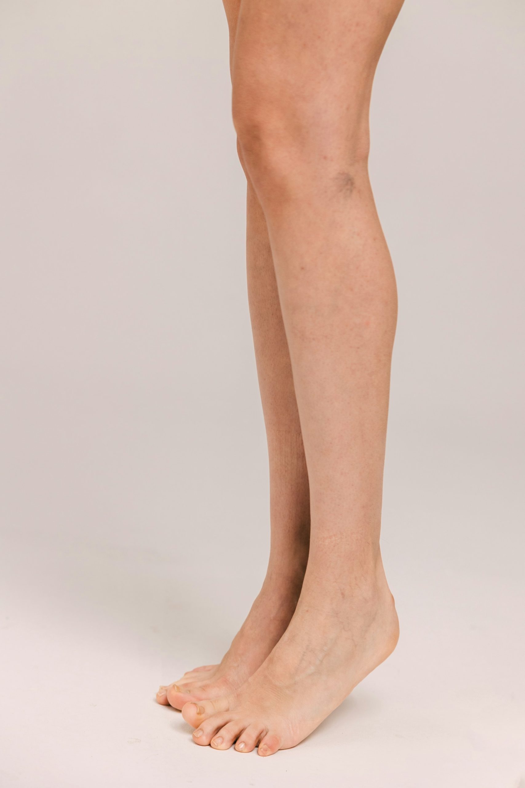 nm-vein-standing-legs-on-white