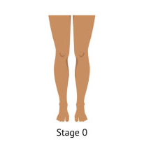 Northern Michigan Vein Specialists - Traverse City