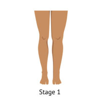 Northern Michigan Vein Specialists - Traverse City