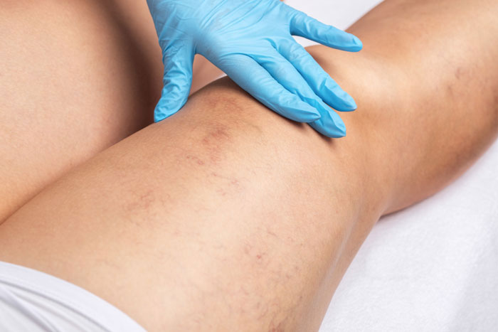 Northern Michigan Vein Specialists - Traverse City